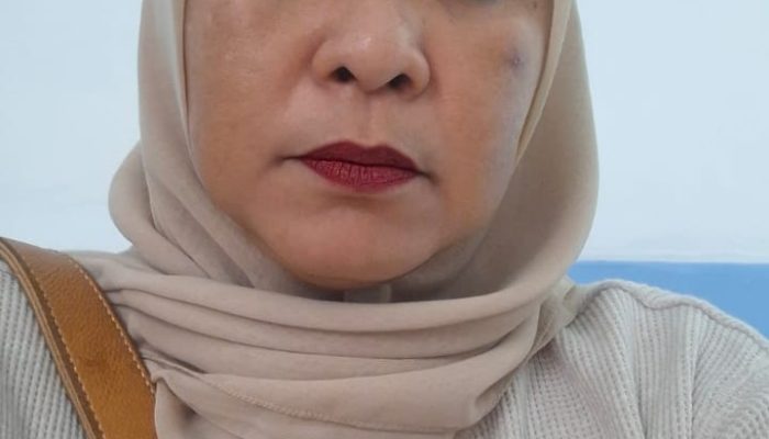 Terkait Penganiayaan Sf Akui Uang Damai Diambil nya